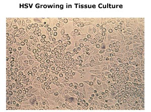 HSV Growing in Tissue Culture
