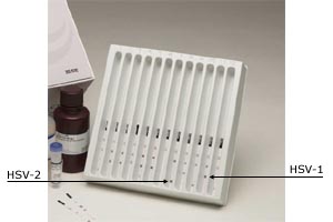 Focus HerpeSelect(TM) Immunoblots